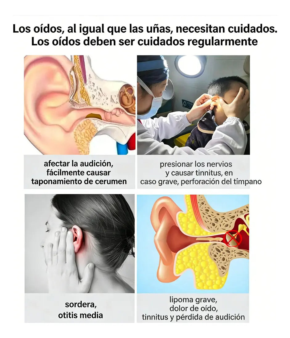 LIMPIADOR DE OÍDOS CON CÁMARA ENDOSCÓPIA - QUITA CERILLA INTELIGENTE